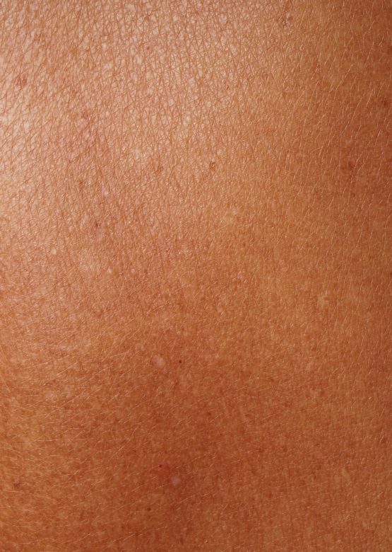 close-up human skin damaged by age and sun tanning