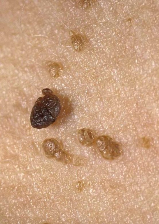 sebks57-8862d0cdef9c4ecfa8cba33871b9efa7-1024x722