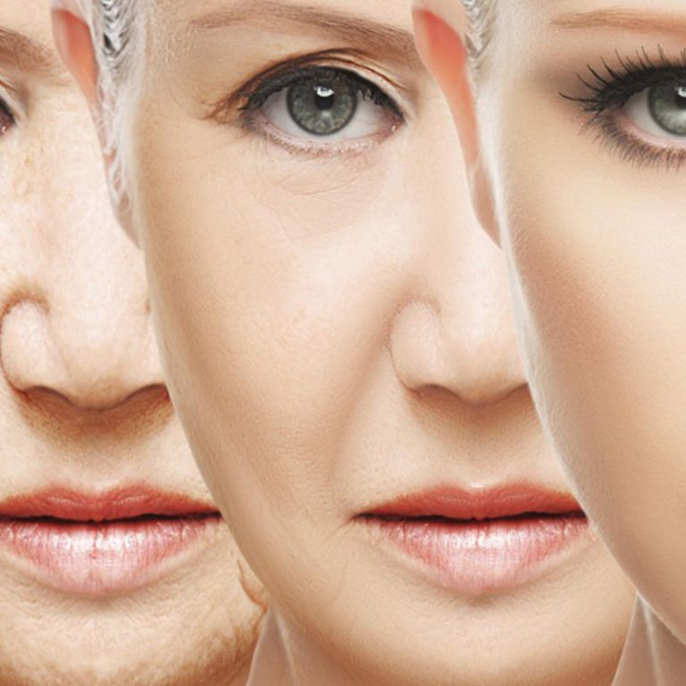 yalouroniko-kai-botox-arthro